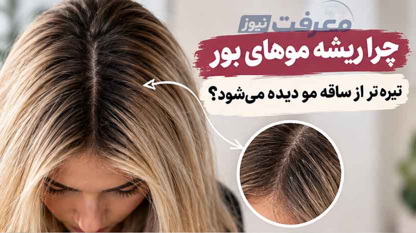 چرا ریشه موهای بور تیره‌تر از ساقه مو دیده می‌شود؟